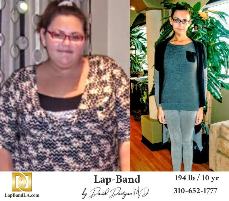 Weight Loss Surgery Bariatric Surgery Gastric Band Lap Band® Gastric Sleeve weight loss surgery