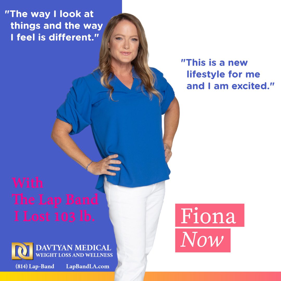 Fiona After Weight Loss Poster lapband surgery los angeles