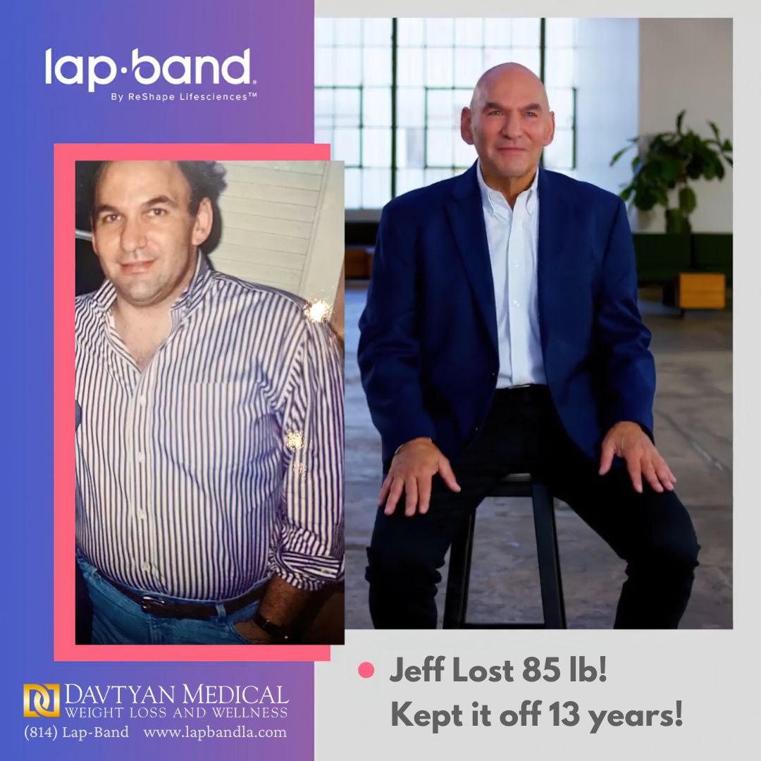 J Weiss 21 lapband surgery